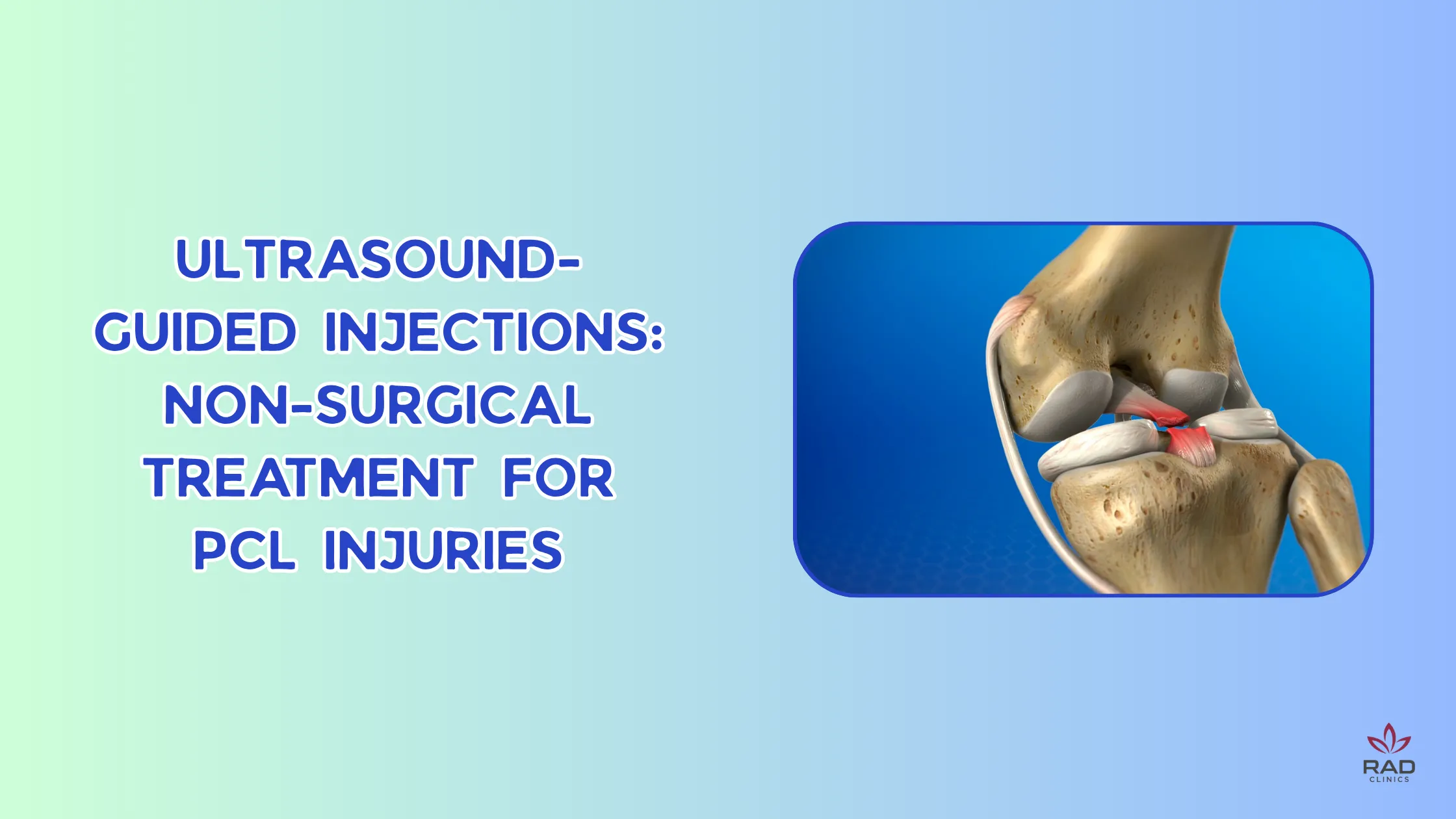 Ultrasound-Guided Injections: Non-Surgical Treatment for PCL Injuries