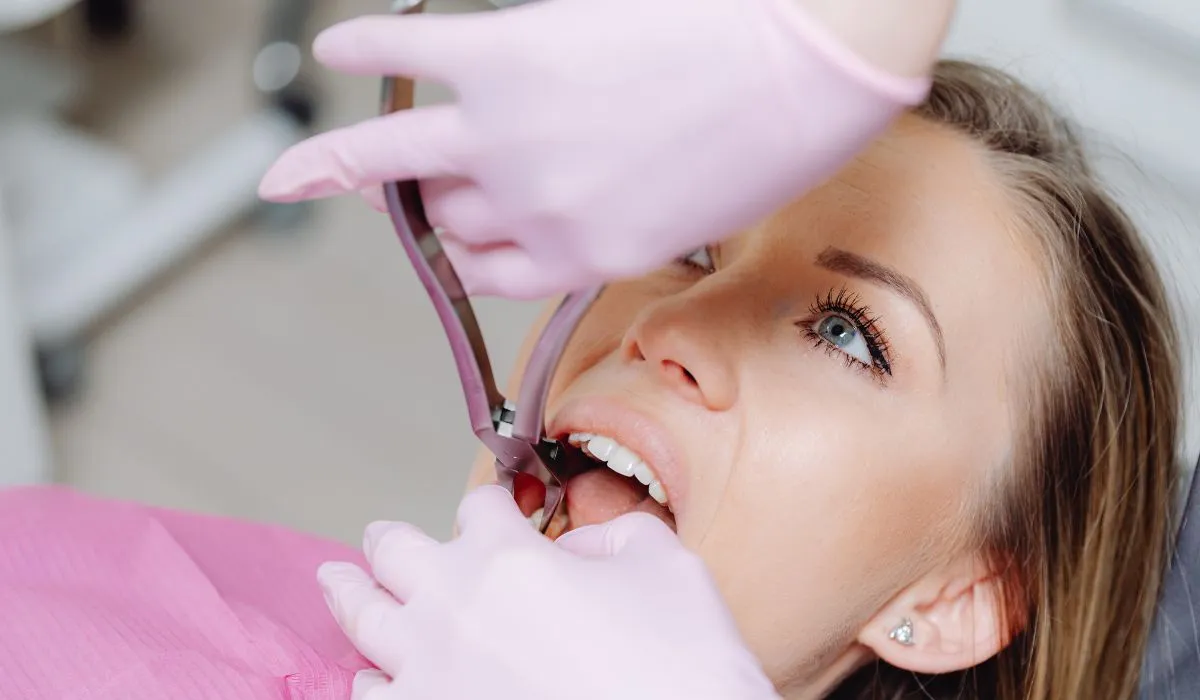 Do You Really Need Root Canal in Simi Valley Today