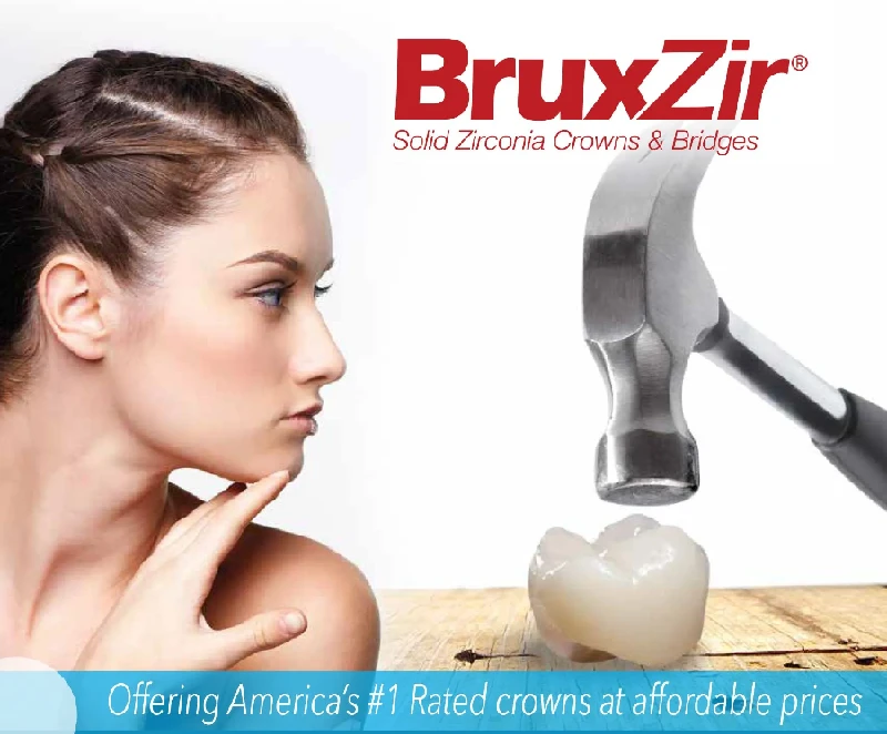 Leading Family Dentist in San Diego Offers Advanced Veneers for a Perfect Smile