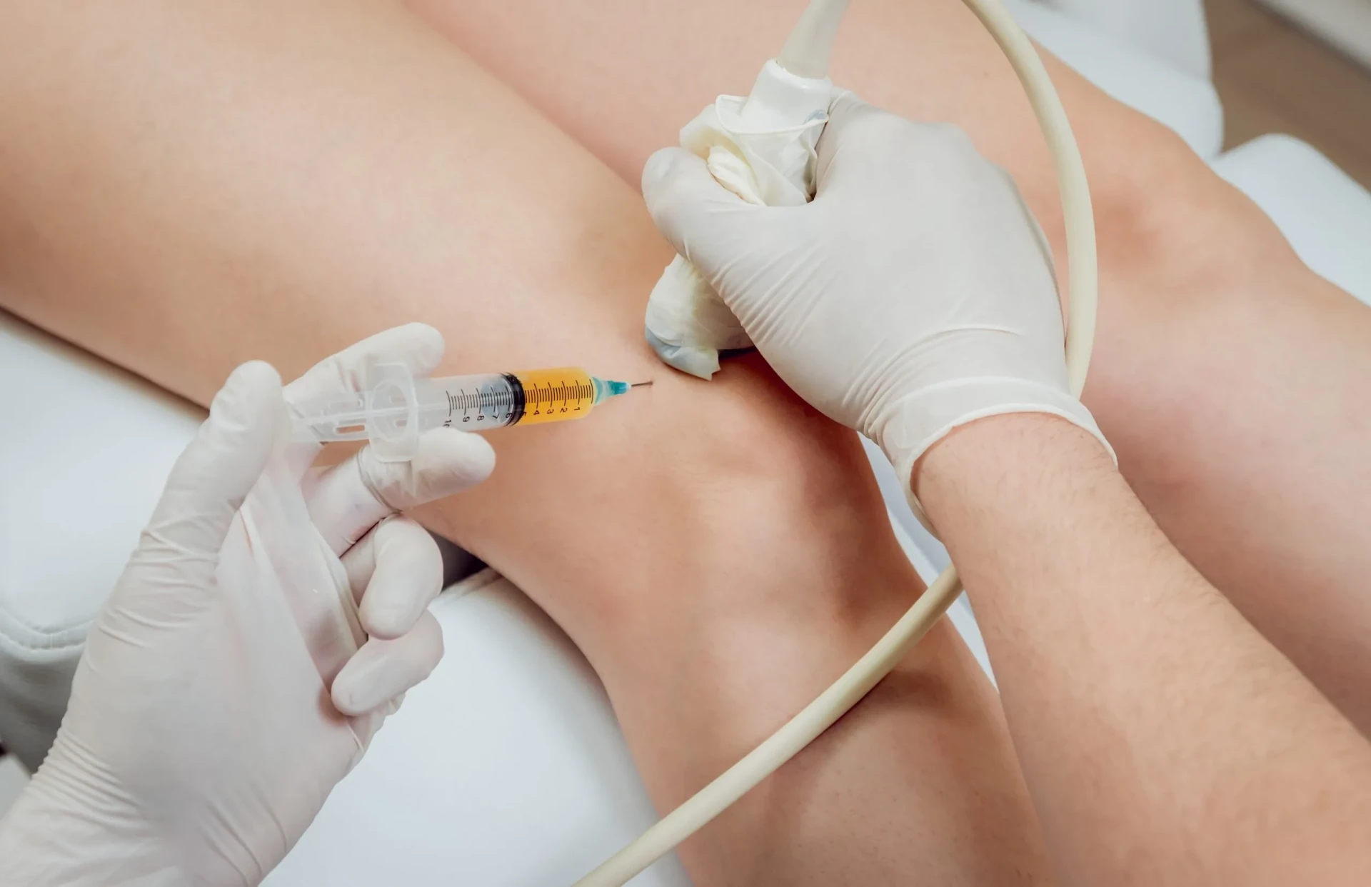 Can Prolotherapy Cause Nerve Damage?