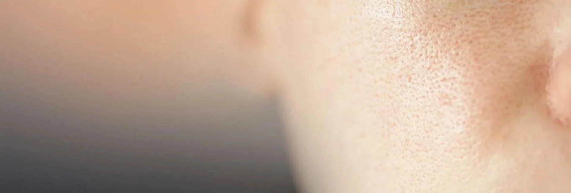 Transform Your Skin with Advanced Open Pores Treatment