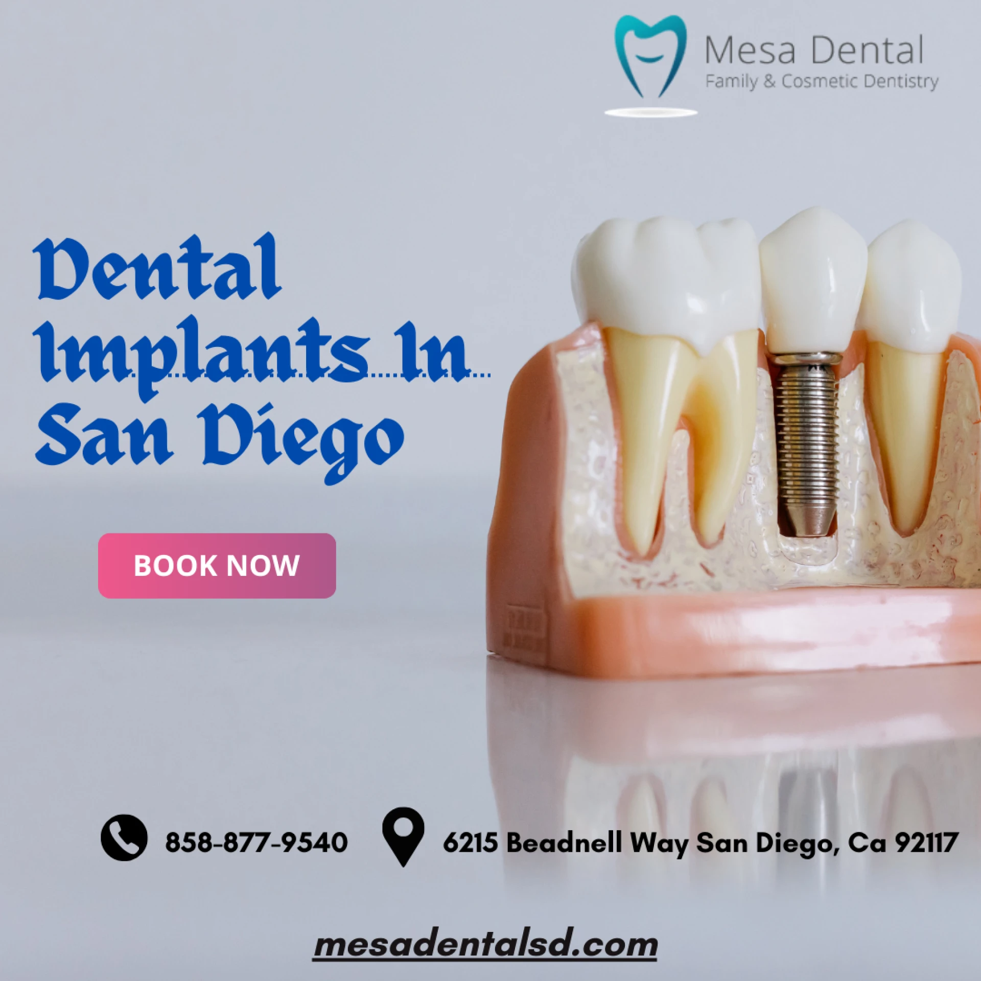 What Makes Dental Implants a Superior Choice for Tooth Replacement? 