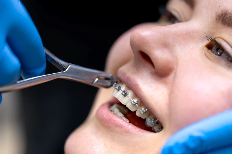 Why Advanced Orthodontist Training Is Essential for Modern Dental Professionals