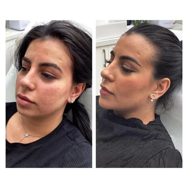 Why a Richmond Skin Clinic is Your Go-To for Radiant Health