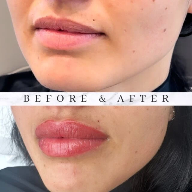 Why a Richmond Skin Clinic is Your Go-To for Radiant Health