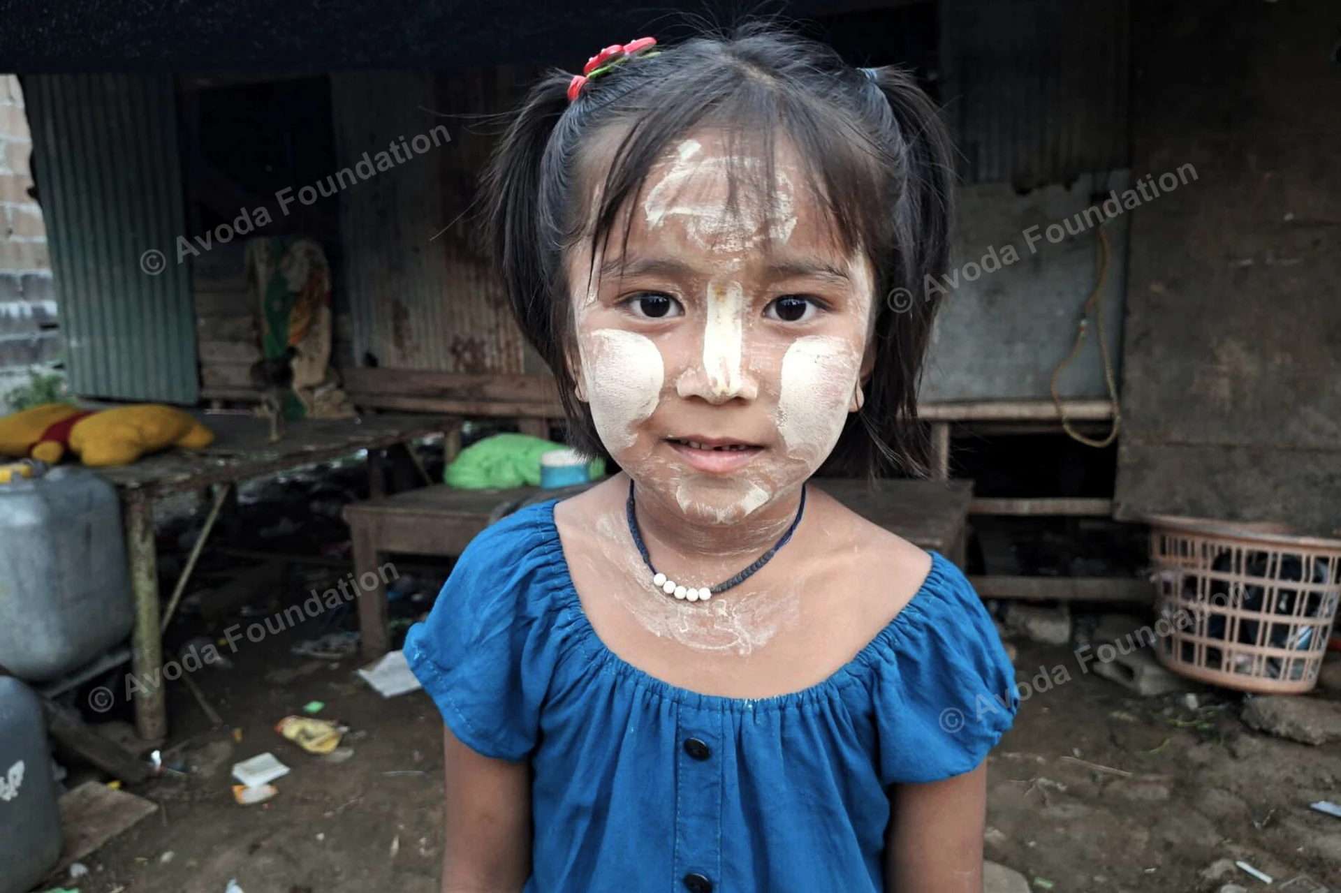 The War and Poverty Have Robbed the Lives of Displaced Children