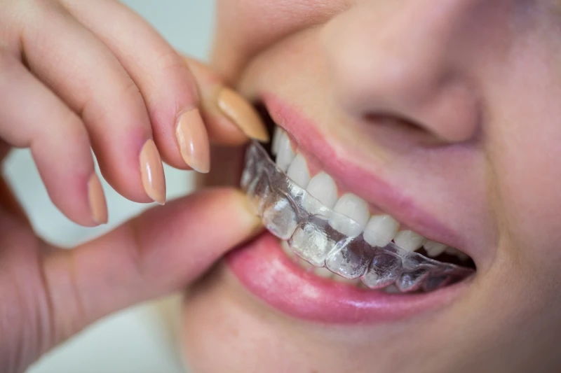 The Importance of Participating in an Orthodontist Course