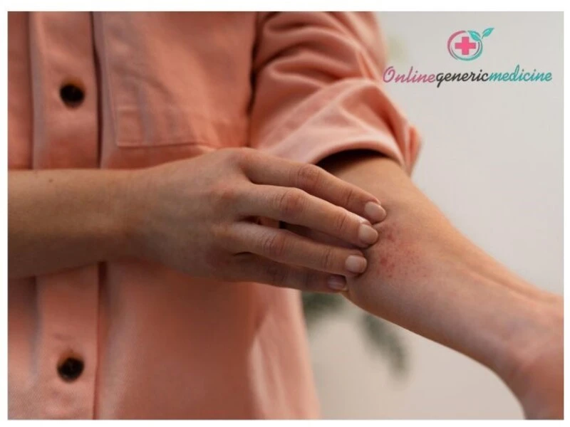 Relieve Pain and Swelling from Vein Clots Using Thrombophob Gel