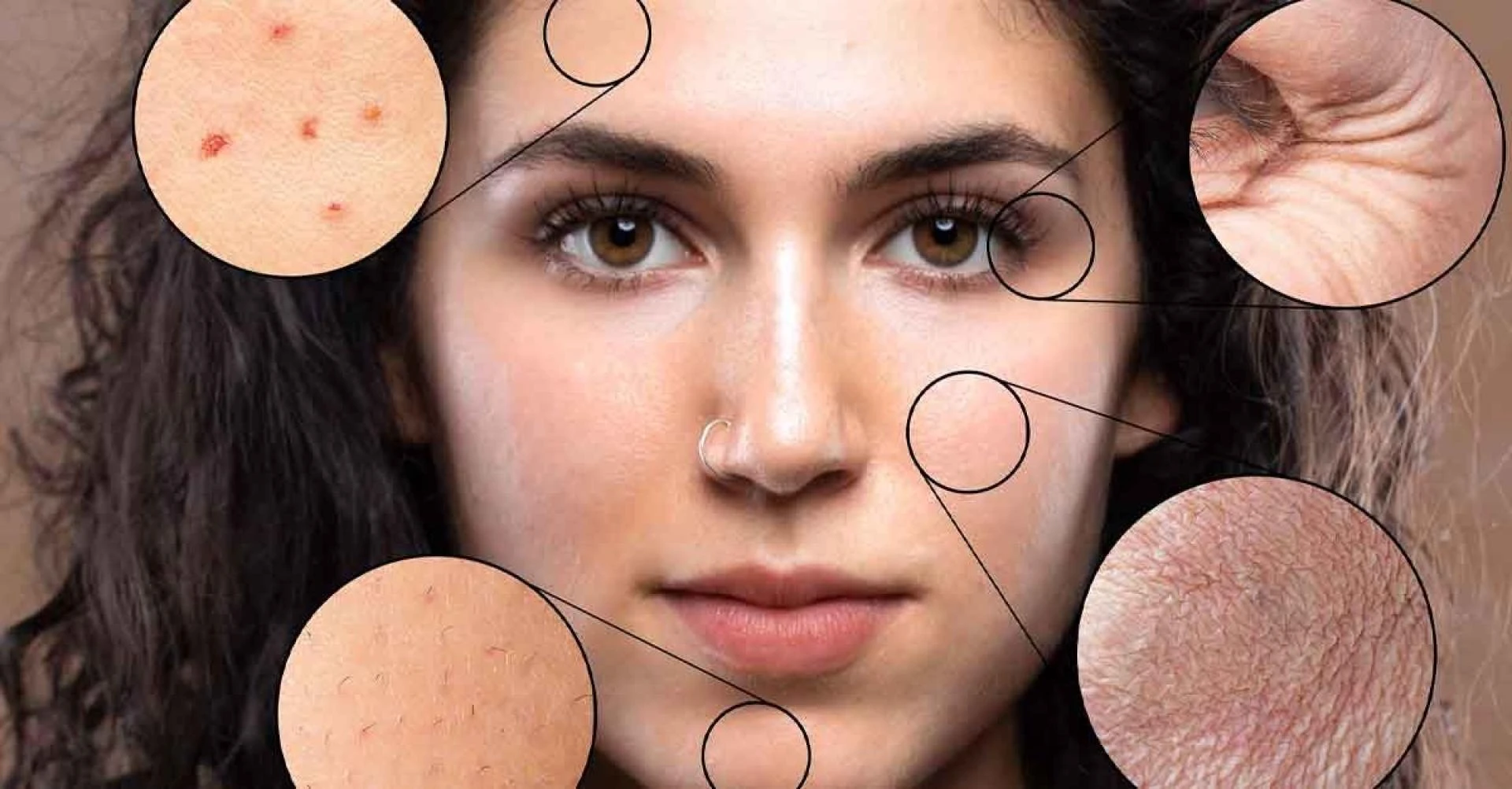 Effective Pigmentation Treatment in Delhi: How to Get the Best, Long-Lasting Results