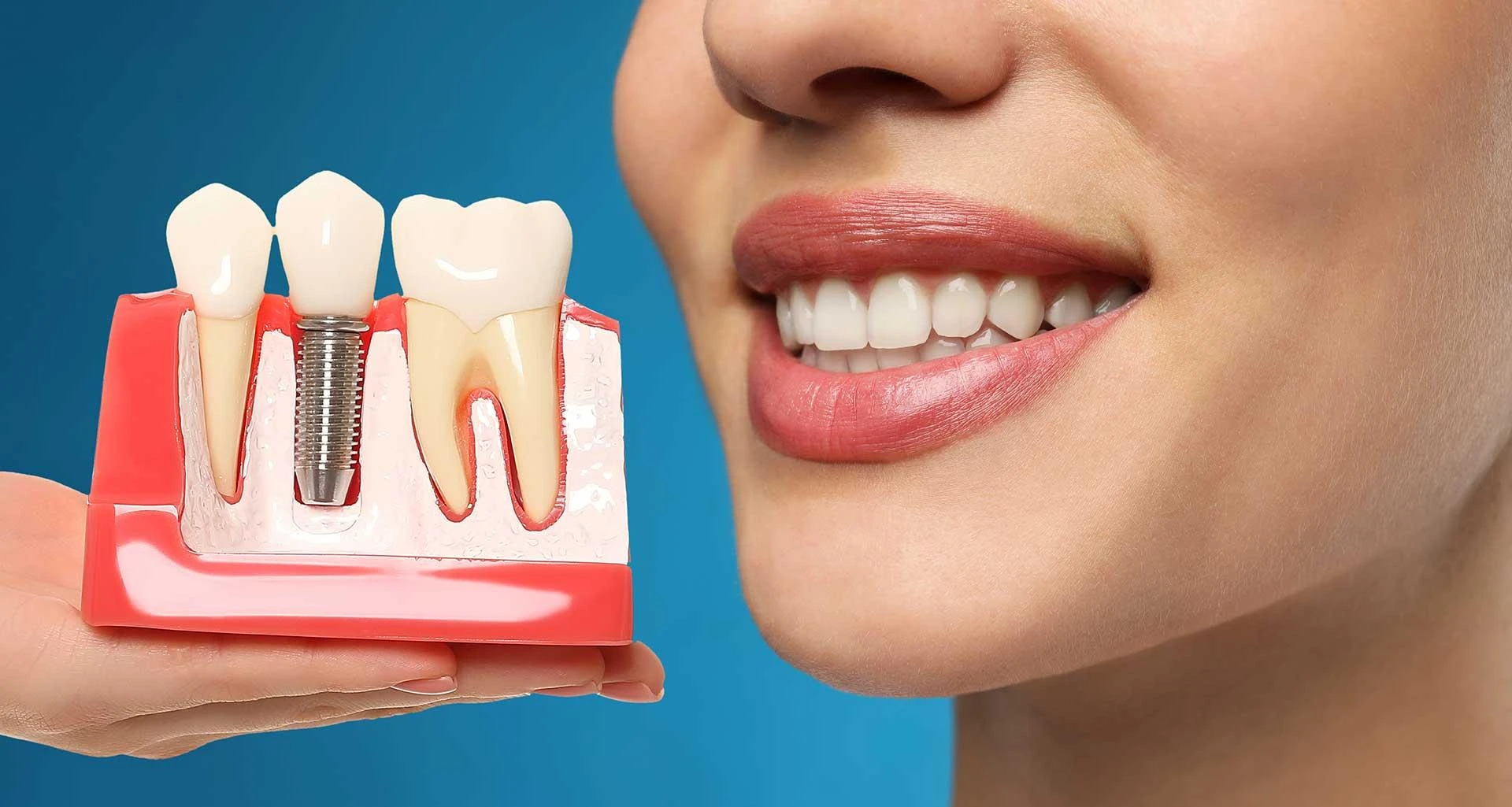 Are Dental Implants Painful?