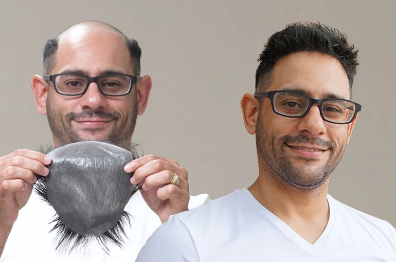 How to Make Your Hair System Look Undetectable: Expert Tips for a Natural Look