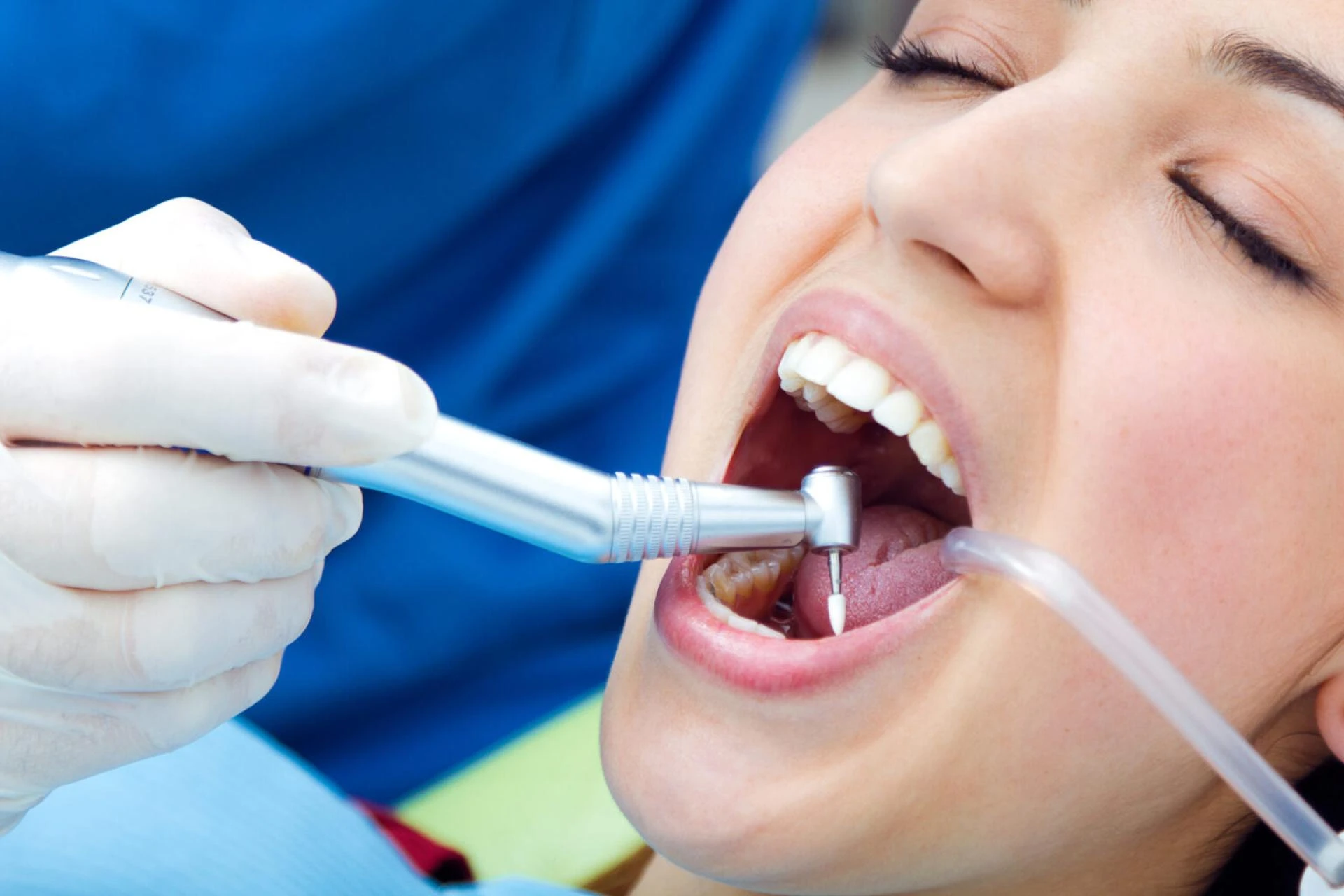 Signs You May Need Periodontal Treatment Immediately
