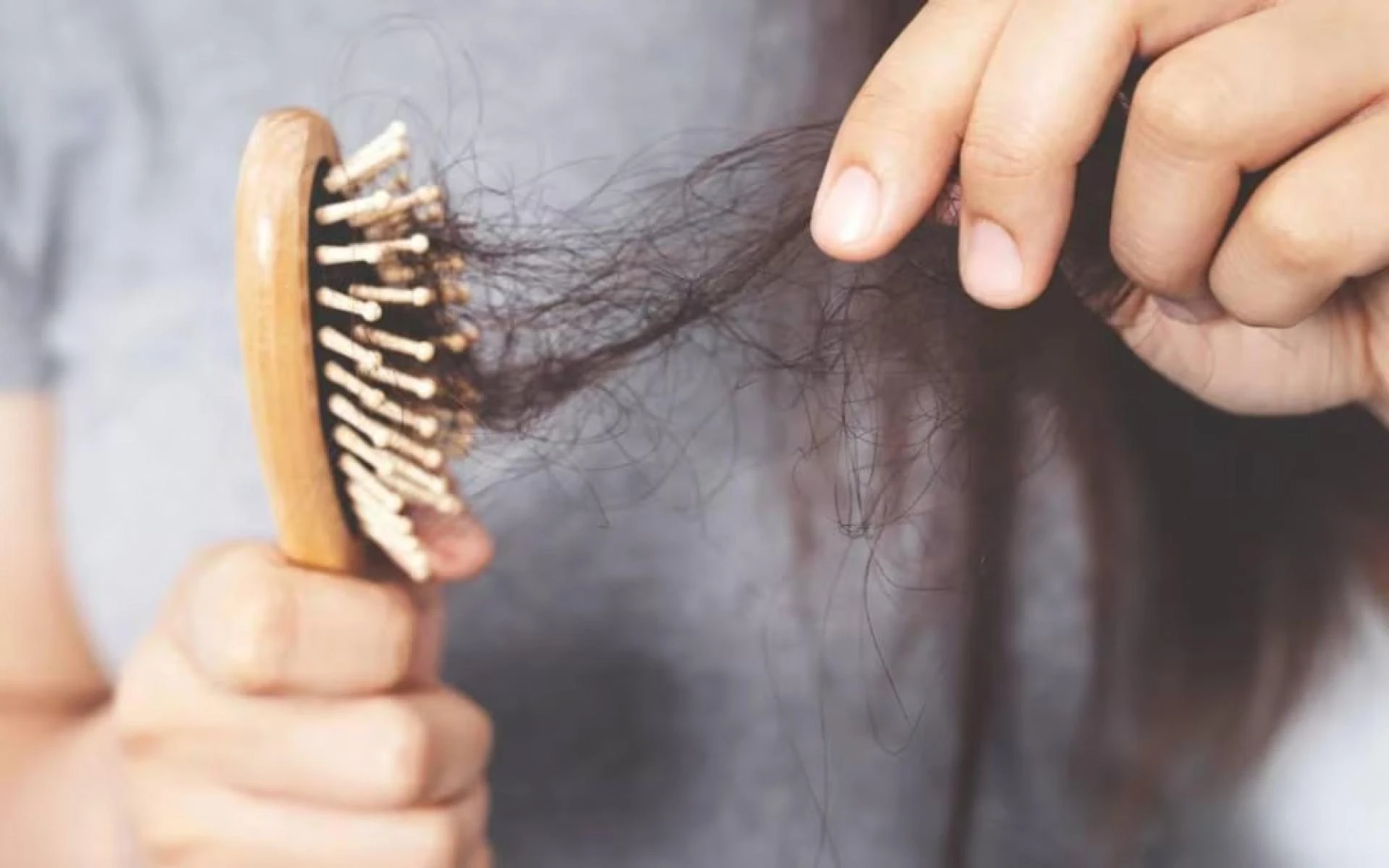 Bicalutamide for FPHL: Safe and Effective Hair Loss Treatment in Delhi