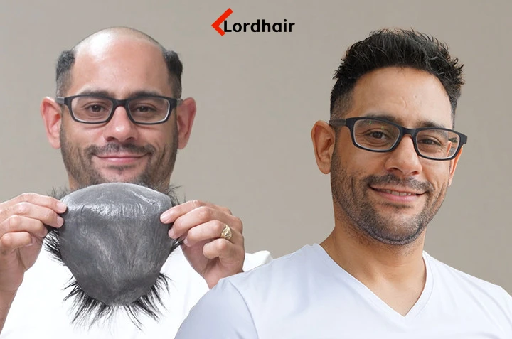 What is a Hair System? Everything You Need to Know Before Buying