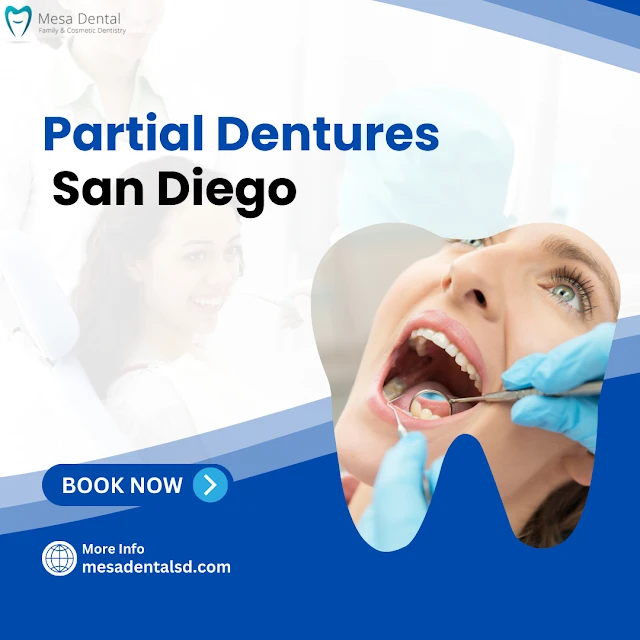 How Long Do Partial Dentures Last and How Can You Care for Them? 
