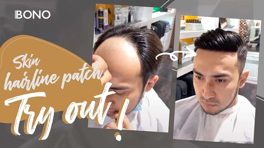 Top Trends in Men’s Hair Replacement for 2025: What Wholesalers Should Know