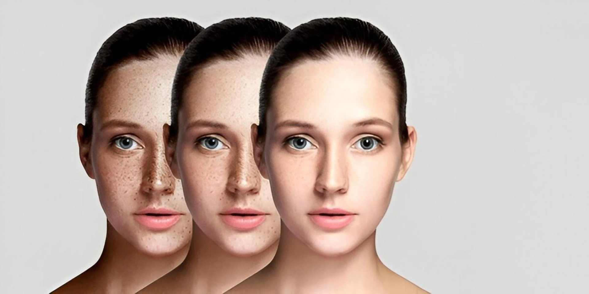 Myths and Facts About Pigmentation