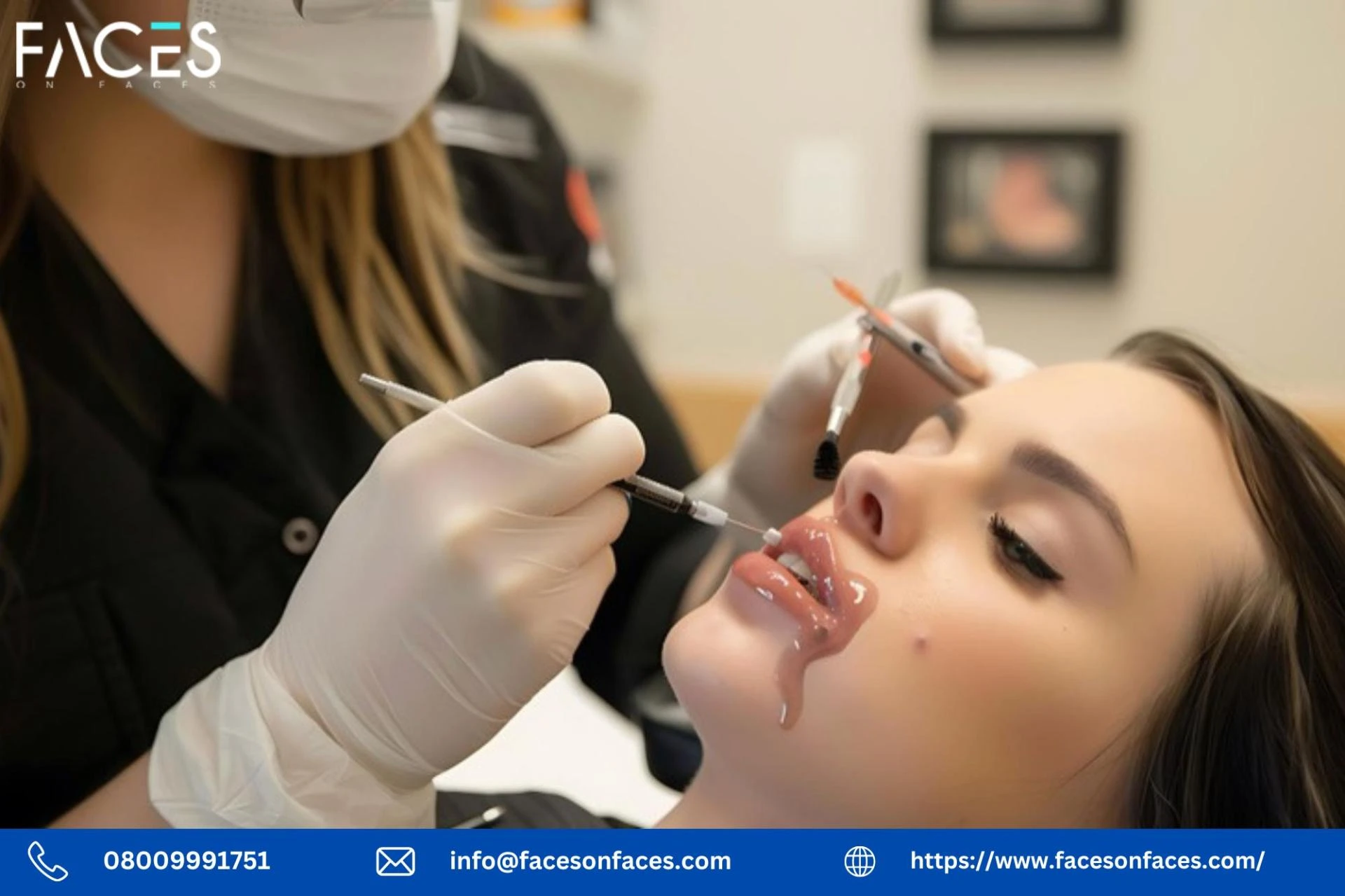 Comprehensive Lip Filler Course in Essex for Safe and Advanced Aesthetic Training