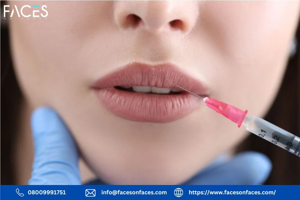 Comprehensive Lip Filler Course in Essex for Safe and Advanced Aesthetic Training