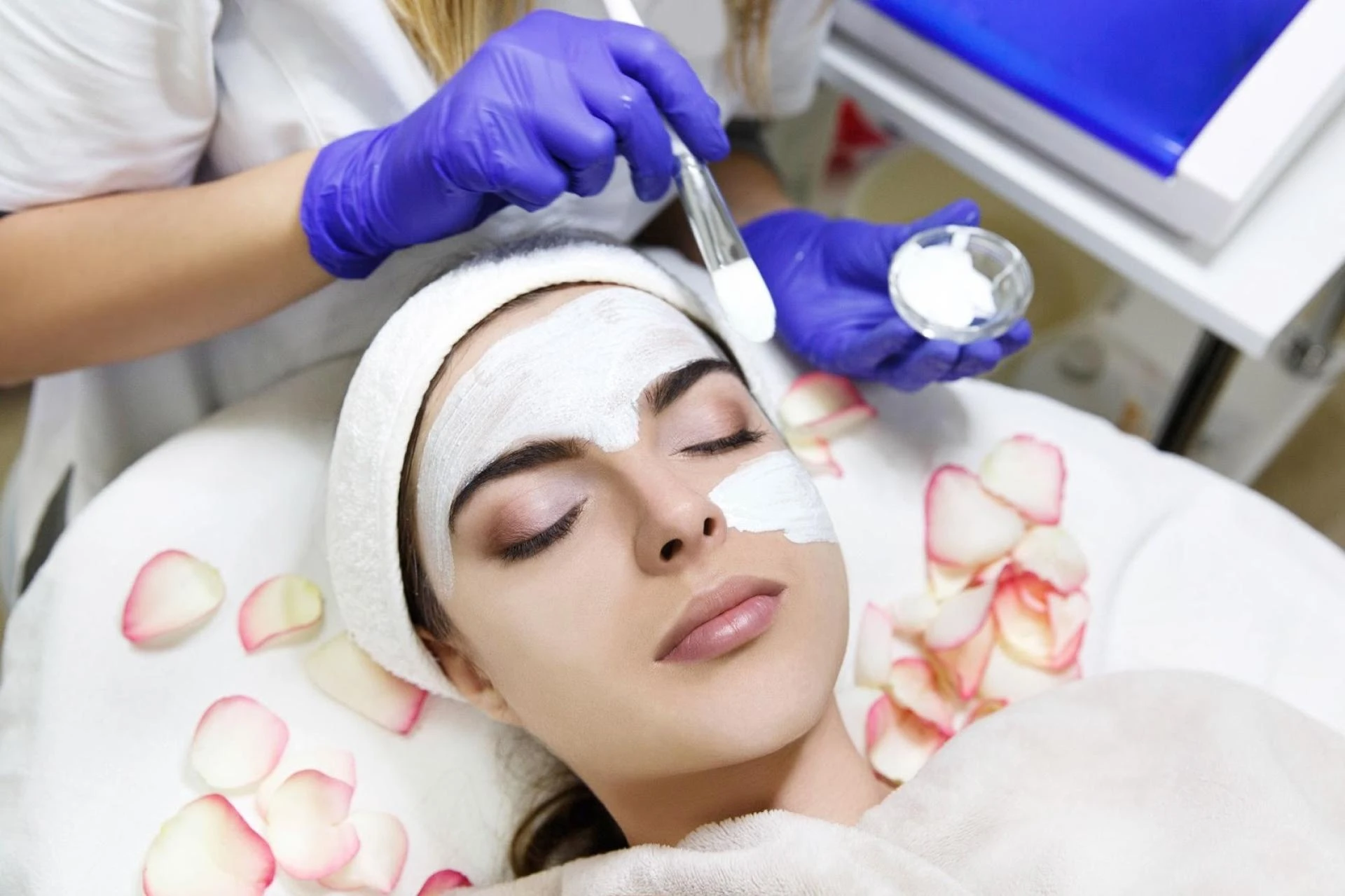 The Benefits of Chemical Peel Treatment