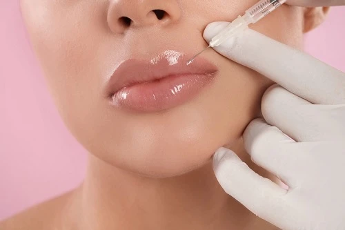 Understanding Modern Lip Enhancement Trends in Florida